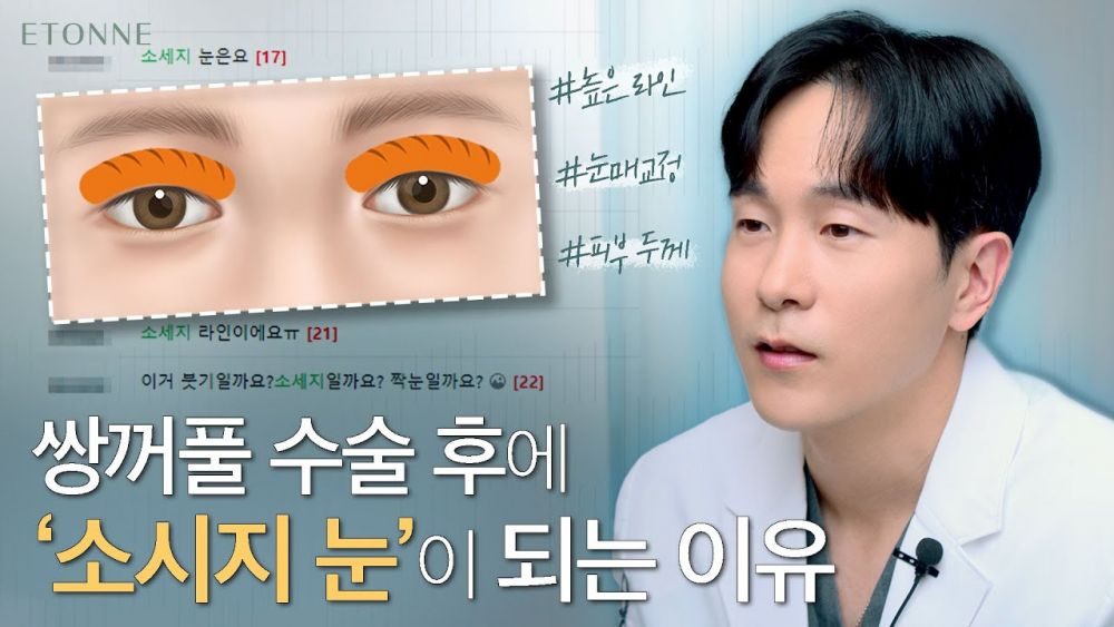 쌍수 전 꼭 확인하세요! 소시지 쌍꺼풀이 생기는 근본적인 이유는?!