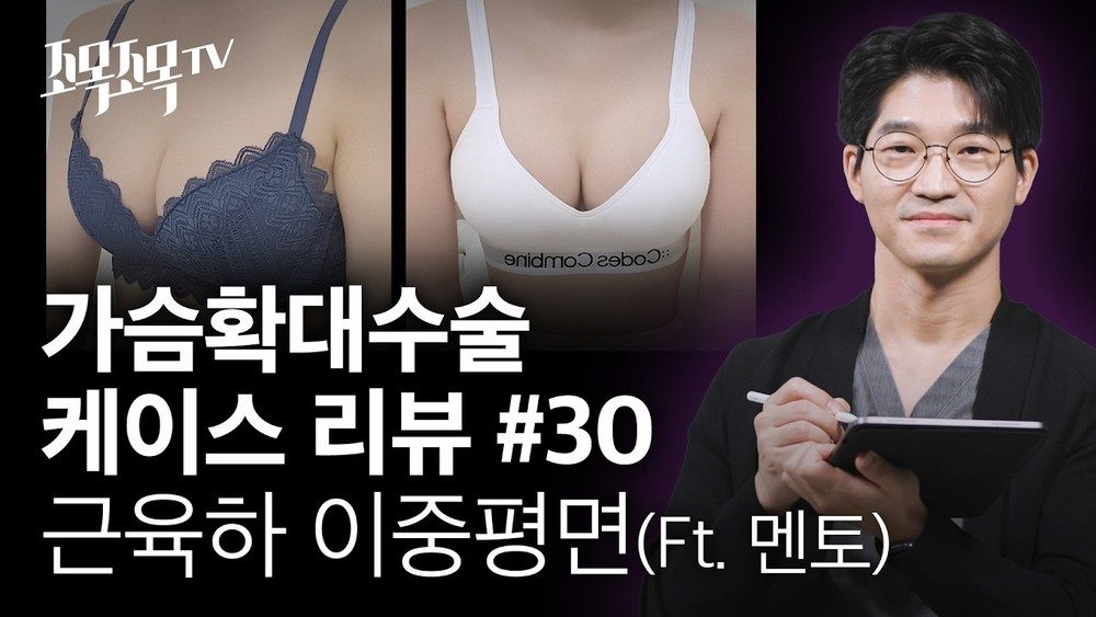 가슴확대수술 케이스 30 - 멘토 엑스트라