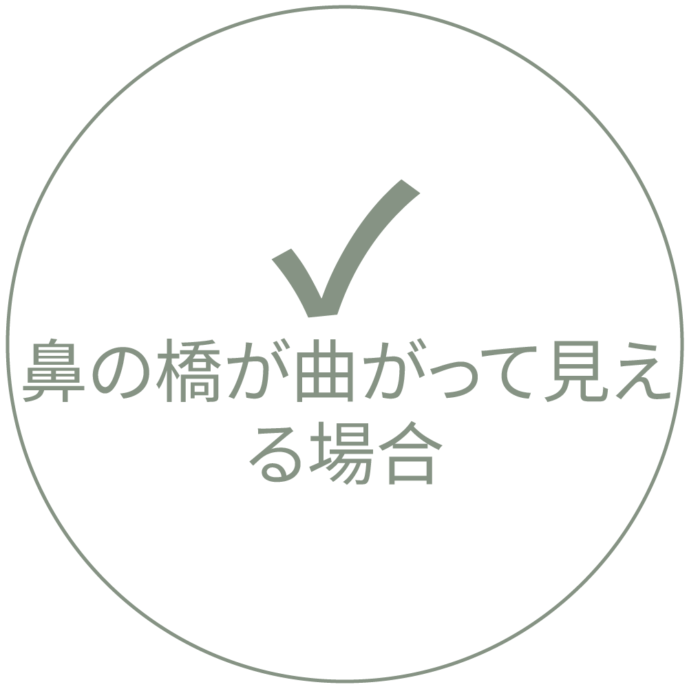 鼻筋が曲がって見える場合