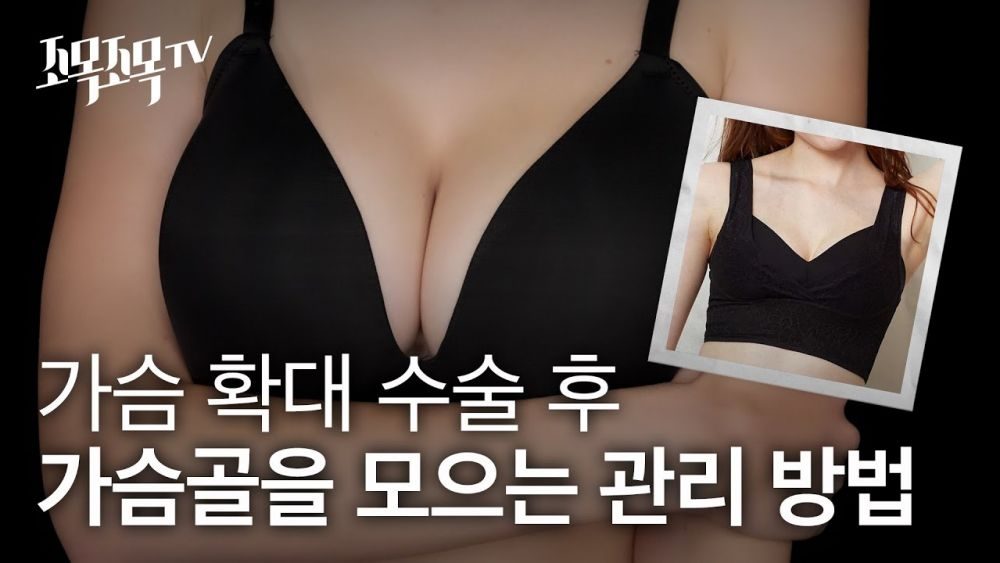 가슴 확대 수술 후 가슴골을 모으는 관리 방법