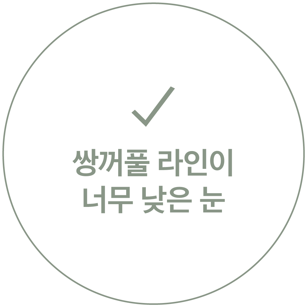 체크 표시와 "쌍꺼풀 라인이 너무 낮은 눈" 문구가 적힌 카드 이미지