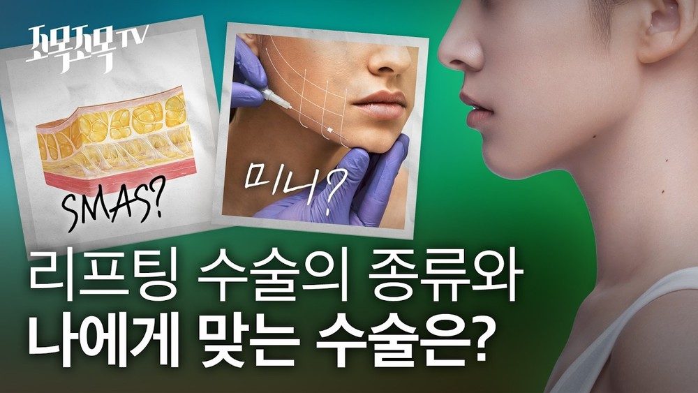 얼굴 리프팅 수술의 종류와 나에게 맞는 수술은?