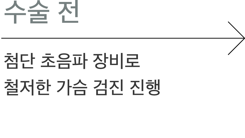 수술 전: 첨단 초음파 장비로 철저한 가슴 검진 진행